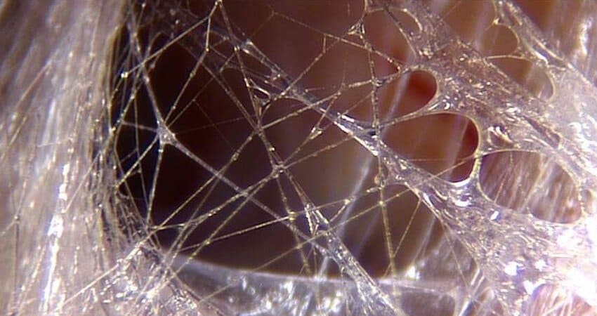 Fascia: The Missing Link in Ehlers-Danlos Syndromes, Hypermobility, and Chronic Pain