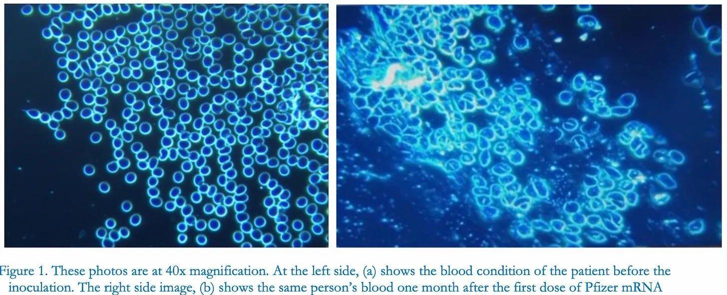 Zeta Potential Rbc Blood Circulation, Zeta Potential, and Vaccines | Chromographics Institute