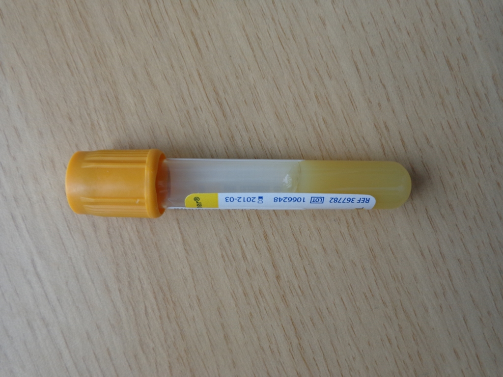 BD Vacutainer® tube with Hemogard™
