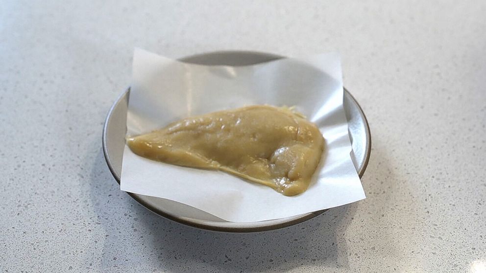 PHOTO: A chicken breast derived from cultured stem cells at UPSIDE Foods in Emeryville, Calif.