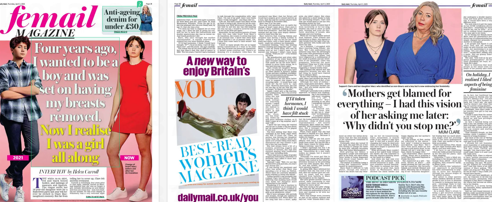 Four years ago, I wanted to be a boy and was set on having my breasts removed. Now I realise I was a girl all along Daily Mail3 Apr 2025INTERVIEW by Helen Carroll Photography: LEZLI+ROSE/MARK HARRISON; Hair and makeup: ALICE THEOBALD @arlingtonartists/DESMOND GRUNDY Change of heart: Macc before and after her de-transition 2021 NOW TINY white ra-ra skirt, red and black boned bodice, and lashings of mascara and lipstick. The risque outfit her 16-year-old daughter wore for a Halloween party last year will forever be etched in Clare Macnaughton’s memory. But far from telling her to cover up, Clare felt secretly overjoyed. Context is everything: four years prior to that night, Isabella, known as Macc, had insisted that she was no longer a girl, initially identifying as non-binary and then as a trans boy – and even binding her breasts. So this overt display of femininity was a very welcome sight indeed for Clare. ‘It has been quite a journey, for both Macc and me,’ says Clare, 53, from Warminster, Wiltshire. ‘From the age of 12, she was adamant she was non-binary and, by age 13, that she was a boy. ‘I’ve done my best to support her at every stage, but I drew the line at giving my consent for her to have the testosterone and double mastectomy she was so intent on. And thank goodness I did.’ Macc, who once thought her mother ‘unreasonable’, is equally relieved she resisted her ever more insistent pleas. ‘If I’d had hormones, I think I would have thought, “S***, I’m in too deep, I can’t de-transition now”, and felt stuck,’ she says candidly. The ordeal was all the more difficult for the fact that Macc’s dad, Kai, died of cancer in 2023. ‘For two years, I haven’t had a husband to talk through the complexities with,’ says Clare. ‘On top of my grief, there were times when I really struggled – and Macc did too. ‘Like me, Kai had a sense that Macc would go back to being a girl. However, her de-transitioning now feels bittersweet because the last time he saw her, she was still insisting she was our son. I would’ve loved for him to see her as his little girl again.’ Meanwhile, for any anxious parents of trans kids who may take heart from Macc’s de-transition, she is keen to stress that hers is an unusual case: ‘I know that when their kids transition a lot of parents think, “Oh, I hope they come back to their senses” but I am rare. ‘I know so many people who are so happy having transitioned so I want to be clear that, just because one person de-transitions, it doesn’t mean everyone will.’ There’s no denying it’s a dramatic volte-face. So convinced was Macc that her future self would have surgery, grow a beard and live as a man, that she and her mother shared their story in Femail in November 2021. Macc was 13 at the time. You may well question how on earth the change of heart came about. Clare puts it down to Macc suddenly realising that she found boys attractive – and that both heterosexual and gay boys were largely disinterested in trans boys like her. Macc believes that wearing bikinis and cropped tops during a family holiday in Kenya – where it was too hot for her usual jeans and shirts, with a chest binder underneath – made her embrace her femininity. ‘I remember thinking, “Ooh I like wearing feminine clothing and acting like a girl”,’ says Macc. ‘I told my friend Keny, who was on holiday with us, but I didn’t want to tell anyone else because I didn’t want them “Told you so!” – even behind my back. ‘My grandmother and other older members of my wider family had said I wouldn’t always be a boy, and that made me all the more determined to prove them wrong. So it was hard proving them right.’ Clare recalls her daughter flirting with a boy staying at the same hotel on Diani Beach in Kenya’s Indian Ocean, and later confiding, crestfallen: ‘He’s not interested in me because I’m trans and he’s heterosexual.’ ‘I comforted her but knew better than to suggest this might be a recurring issue – it would have only made her dig her heels in,’ says Clare. ‘However, back home, she told me one day, in the car, that she was no longer “so fixated on gender”. ‘Again I didn’t give a big reaction, just nodded along. But I was secretly hopeful. Then, when she was starting sixthform college the following month, I asked what gender she wanted to register her place in and she said “girl”. ‘By then, she was wearing make-up and more feminine clothes, so it didn’t come as a big surprise, and I said “OK”. ‘I knew the last thing she wanted was for me to make a big fuss about her de-transitioning so I’ve played it very cool.’ The first inkling that Macc was ‘unhappy in her body’ came when she was 12 years old. Clare, an author, was driving her daughter home from the stables where she spent a lot of time riding when Macc announced she was neither a girl nor a boy, but non-binary. She had always been a bit of a tomboy, preferring joggers and hoodies to dresses, but had also enjoyed playing with traditional girls’ toys, including dolls. ‘There had been no signs of gender dysphoria beforehand, otherwise I’d probably have taken it more seriously,’ says Clare. ‘Instead I said, “Well, it’s not like Woolworth’s pick and mix, you don’t just choose one.”’ It was during the pandemic and Clare was aware that Macc was spending a lot of time on TikTok, where there are currently 43million posts relating to being non-binary. Telling herself it was probably just a phase, Clare ‘just listened’ – firmly believing that pushing back would only make her daughter more entrenched in her beliefs. Wondering if it was a reaction to societal pressures to be sexual once you hit puberty, Clare confided in Macc that she hadn’t felt especially girly as an adolescent, either. She’d been unhappy with periods and breasts, though she embraced her femininity now. When Macc cut her long hair into a short, spiky style, she didn’t object. But when she asked for a chest binder to hide her developing breasts, Clare said that she would need to use her own spending money for that. An internet search revealed that if worn incorrectly or for too long, binders can lead to chest or back pain, bruising and even rib fractures, shortness of breath, skin damage and over-heating. When the £12 black binder arrived from Amazon, Clare relayed this information to Macc, who agreed to take breaks from the tight crop topstyle garment with hooks and eyes down one side. ‘As a feminist, I struggled with Macc rejecting being female,’ she says. ‘But I also understand why someone may want the advantages that come with presenting as male.’ Telling herself this ‘phase’ had been triggered by a combination of the onset of puberty and the weirdness of the pandemic, Clare was pragmatic, believing the most important thing was to stay strong and supportive – in order to avoid triggering a ‘mental health crisis’. Her husband Kai agreed and was supportive because, she says, the last thing he would have wanted was to alienate Macc. By her 14th birthday, the following April, Macc had decided she was no longer non-binary but, in fact, a boy. Although her style of clothes – jeans, cargo pants and shirts – didn’t change, her pronouns became he/ him – and woe-betide anyone who got them wrong. ‘Although I generally took a chilled approach, no matter how challenging it was hearing her talk about “chopping her t**s off”, I remember Macc shouting at me after I mistakenly referred to her as “she”,’ recalls Clare. ‘I blurted out, “They, them, him, he, she, her, it – whatever!” in frustration. ‘I consider myself pretty liberal-minded but tip-toeing around all of these pronouns – some of which seem ungrammatical – felt utterly exhausting. Macc called me “disrespectful” and I remember rolling my eyes, like a teenager myself. It wasn’t my finest moment.’ When Clare asked why she had decided to identify as a boy, Macc’s only explanation was: ‘Because it makes me happy.’ ‘If she’d told me she felt more affinity with boys, it would have made more sense, but this felt like a fairly vague reason for doing something so extreme,’ says Clare. ‘I didn’t challenge her but I do remember offloading to friends, saying, “Identifying as a size eight makes me happy, but it doesn’t make it real!” ‘Although I’ve never put this to Macc, I had a sense that this gender journey was rooted in her need for attention because in the preceding years her older brother, Ben, who’s 21, and has ADHD, had needed more parental support.’ In spring 2022, Macc informed her teachers that she was now a boy and, after her mother gave her consent by email, had her name changed from Isabella to Macc Macnaughton on the register. She used ‘gender neutral’ toilets in school, while continuing to visit women’s loos when out and about, finding the men’s ‘gross’. She also stuck to the girls’ changing rooms for PE because she felt self-conscious undressing in front of boys and wanted to be with her female friends. Macc had always worn trousers as part of her school uniform and says her ‘woke’ friends didn’t comsaying, If I’d taken hormones, I think I would have felt stuck ment on either her initial declaration that she was non-binary, or her subsequent transition to being a boy. Eventually, when she turned 16 last April, she paid £50 out of her own savings to change her name by deed poll, officially becoming Macc Kai James Macnaughton. Still grieving her father, a Squadron Leader and helicopter pilot in the RAF, who died within three weeks of being diagnosed with blood vessel cancer, she wanted to honour him. The impact of suddenly losing a loving and ‘supportive’ father cannot be underestimated. Macc finds it difficult to talk about, though she doesn’t believe his death had any bearing on her de-transitioning. Clare, meanwhile, is unsure what, if any, impact it may have had. It was just a month after changing her name by deed poll, while on their holiday in Kenya, that Macc began to question her gender again. While previously, Macc couldn’t look at her naked body without the binder, she was surprised to find she enjoyed strutting about on the beach in a bikini. And while she had only ever dated girls, she suddenly found herself attracted to boys – and now considers herself bisexual. The desire to embrace her femininity was so great that, back home in Warminster, Macc ditched the chest binder and began dipping into her mother’s make-up bag. ‘It was strange, at first, seeing my reflection in the mirror – how “girly” I looked in mascara and lipstick,’ says Macc. ‘But I don’t wear much make-up and my hair is still pretty short, so my friends tell me I look like a lesbian, which I’m happy with.’ Last September, Macc started college, where she is studying a Level Three Extended Diploma in Public Services. She registered as a girl – ‘Isabella, known as Macc’ – and began growing her hair and buying her cosmetics. Her favourite brands now include Rimmel and MUA. Watching the re-blossoming of her ‘beautiful daughter’, but fearing that too much attention might send her scuttling back to her more androgynous look, Clare was careful to say as little as possible. Clare’s new partner, Pete, whom she met eight months after Kai’s death, now lives with them. ‘I do have to say something when she walks around the house in her bra and hot pants,’ says Clare, laughing. ‘Otherwise, I turn a blind eye, including to the dresses she’s just bought from ASOS – short and strapless, with crossover backs, in flimsy Lycra.’ Clare believes this ‘unhysterical’ approach to parenting has been instrumental in helping to steer her daughter through the various stages of her gender journey. Her advice to other parents whose children identify as transgender is not to bow to pressure to consent to hormones and surgery – encourage them to wait until they’re 18 and can take those steps, should they still choose to, as adults. As a result, Macc’s return to being a girl involved nothing more arduous than changing her legal name back, by deed poll, to Isabella Elizabeth. Had she undergone a double mastectomy and been given testosterone, it would have been a very different story. The next step is to get the name on her GCSE certificates altered from Macc – something the exam boards say can be done – so as not to confuse future employers who may ask to see them. As for letting her friends know, Macc used her generation’s preferred way of communicating and simply changed her pronouns to she/her on Instagram. ‘I let people just figure it out when they saw me wearing make-up and everyone was really polite, not mentioning it or just asking, “Are you going by ‘she’ now?”,’ recalls Macc, adding, with a smile: ‘But my granny didn’t hide her feelings. ‘She said, “Ooh look at my gorgeous granddaughter!” All her other grandkids are boys, so I think she’s glad.’ Macc is conscious that most people in her small town are aware of the journey she’s been on. In fact, her boyfriend has been teased by friends who tell him he’s ‘dating a boy’. ‘I’m sure they call me slurs behind my back, but I don’t ask,’ she says. ‘And he doesn’t care what they say, he’s pretty strong-minded.’ What, I wonder, with the benefit of hindsight, does Macc make of her journey from girl to boy and back again? ‘I think it came from the sexism in the world, how women are hated on, and how privileged men are,’ she says. ‘At first I fancied being not fully a boy, but mostly a boy, and then I thought I want to be fully a boy and was serious about getting top surgery and starting on testosterone. ‘That changed though, on that holiday, when I realised I liked aspects of being feminine.’ And what of the role of TikTok, which Clare feels played a significant part in all of this? ‘I already felt not feminine, more masculine or androgynous, and then I found non-binary TikTok and trans TikTok and thought, “Oh, that’s how I feel”. I could really relate to it and I just felt really seen.’ Looking back, Clare is relieved to have ‘neither prevented nor enabled’ Macc’s transition. ‘It was self-protection, as much as anything,’ she says. ‘We mothers get blamed for everything, and I had this vision of an older version of Macc asking, “Why didn’t you stop me? Why did you let me do that? I was a child, you should have known.” ‘I’m not sure how significant, or not, my response to all this has been because, ultimately, what changed is that Macc’s transgender status had become an obstacle to her desires. ‘However, it is lovely having my beautiful, feisty, opinionated daughter back. ‘And her new-found interest in fashion, make-up and the length of her hair certainly makes for more enjoyable conversation than her preoccupation with pronouns.’ Mothers get blamed for everything – I had this vision of her asking me later: ‘Why didn’t you stop me?’ MUM CLARE On holiday, I realised I liked aspects of being feminine Article Name:Four years ago, I wanted to be a boy and was set on having my breasts removed. Now I realise I was a girl all along Publication:Daily Mail Author:INTERVIEW by Helen Carroll Start Page:32 End Page:32