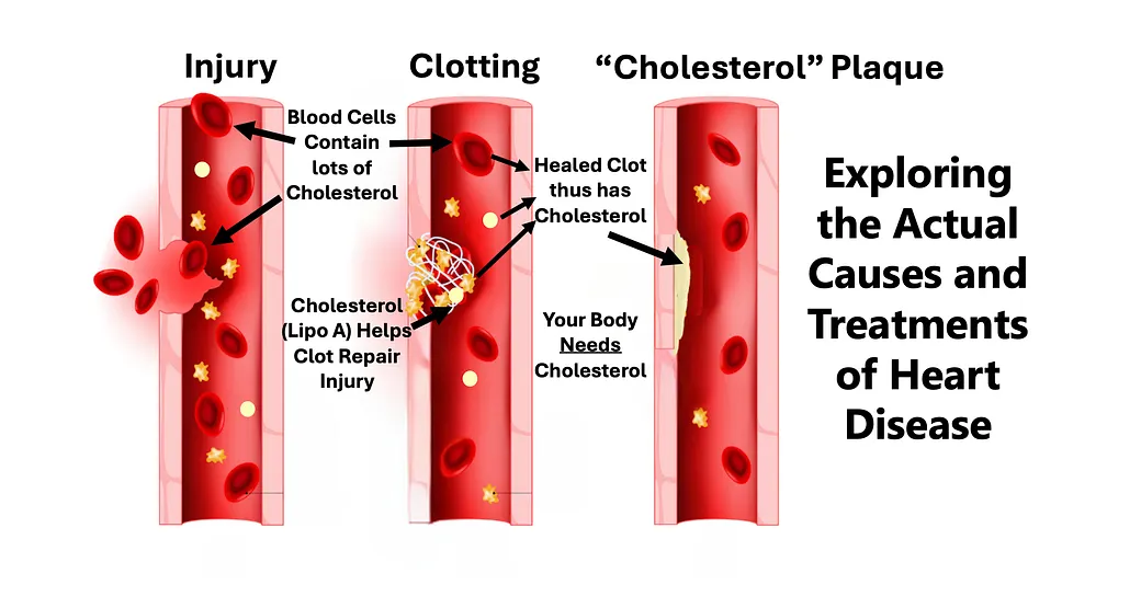 midwesterndoctor.com - A Midwestern Doctor - The Great Cholesterol Lie and The Dangers of Statins
