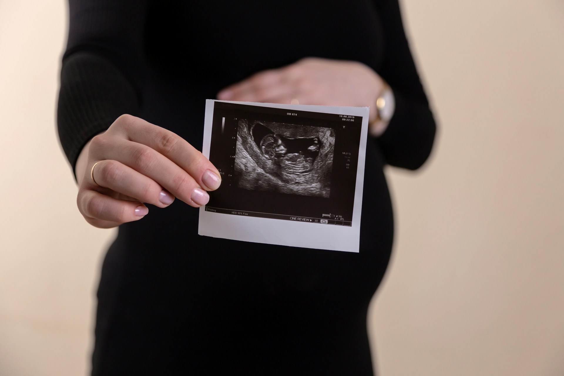 McKenna West’s Case and the Limits of “Her Body, Her Choice.”
