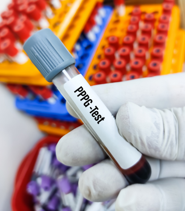 Gray top tube contents