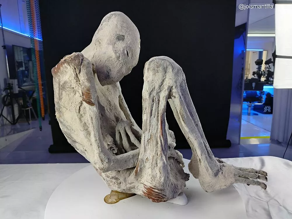 Arqueólogos descobrem ossos de bebê em útero de múmia 'alienígena' com implantes metálicos de 1.200 anos no Peru