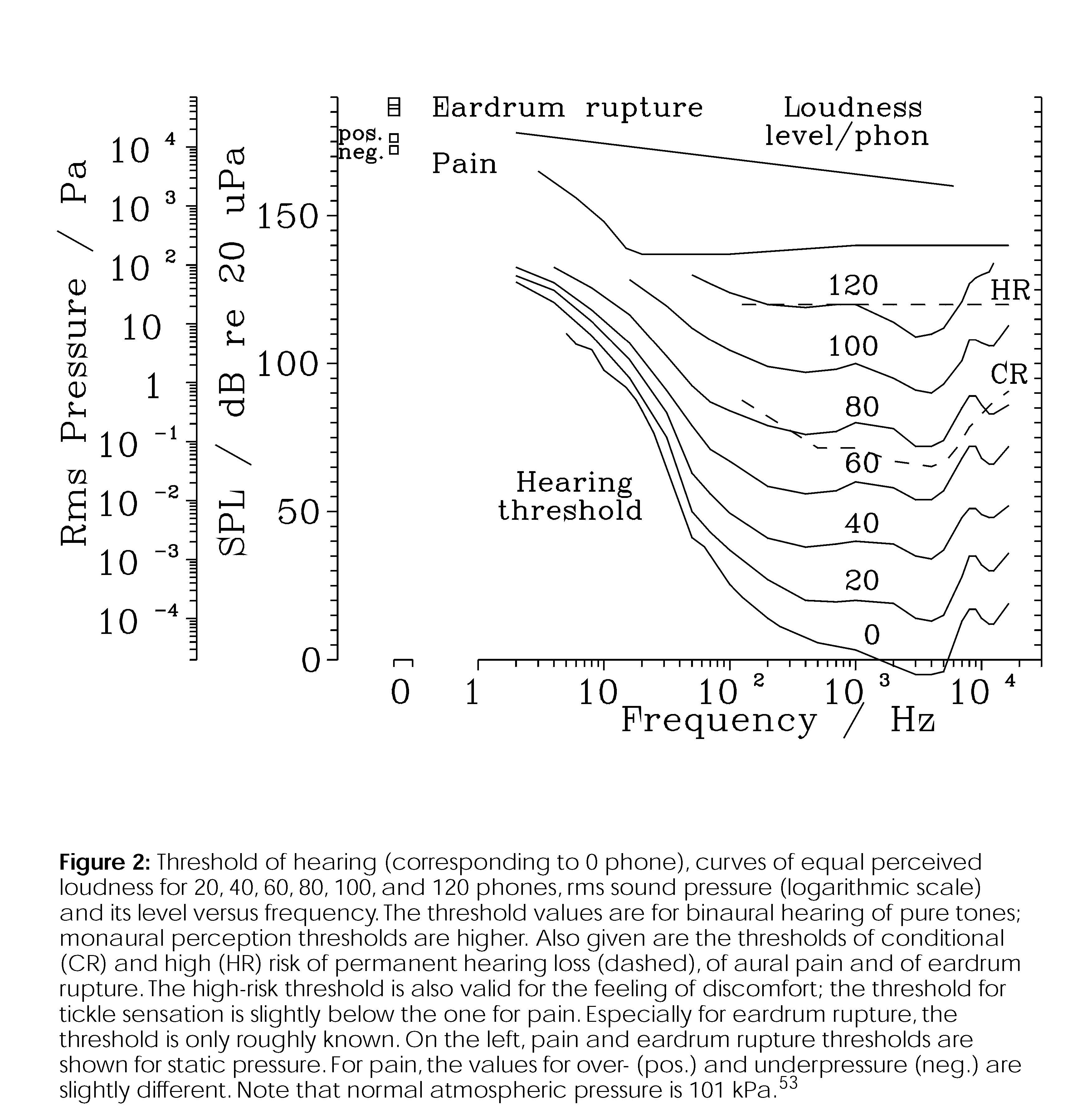 Long Range Acoustic Device (LRDA) [i] - by Mike Mihajlovic