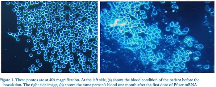 blood condition of the patient before inoculation