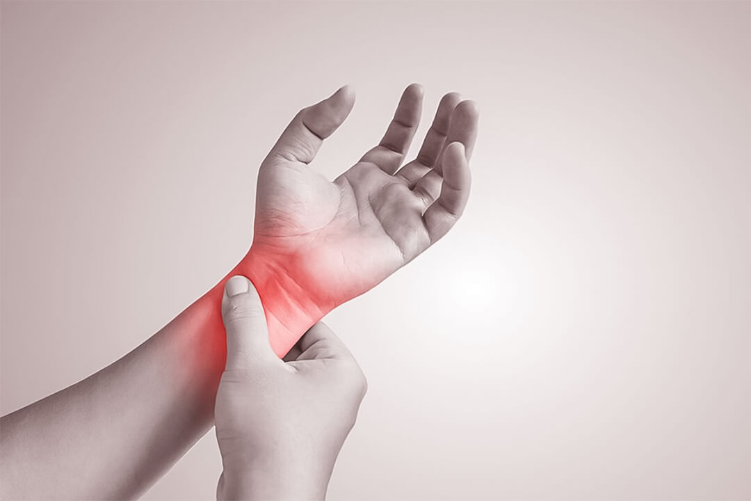 Complex Regional Pain Syndrome (CRPS):