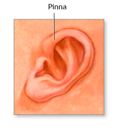 Positioning Pinna Pediatric Pearls: Infant's Ear - Pits, Tags, and the Pinna