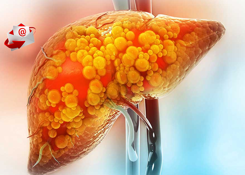 ★ Does This Tiny Sea Creature Hold a Secret to Melting Liver Fat?