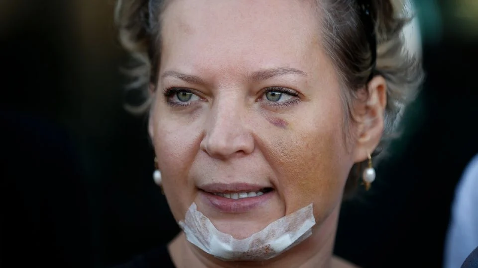 Joice Hasselmann acusa família Bolsonaro de agressão e revela detalhes explosivos sobre Michelle em podcast