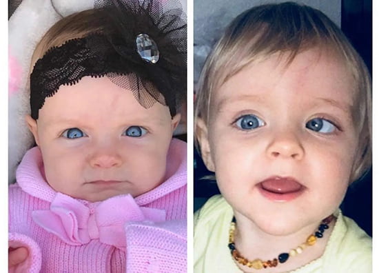 disabled after vaccination after 4 months