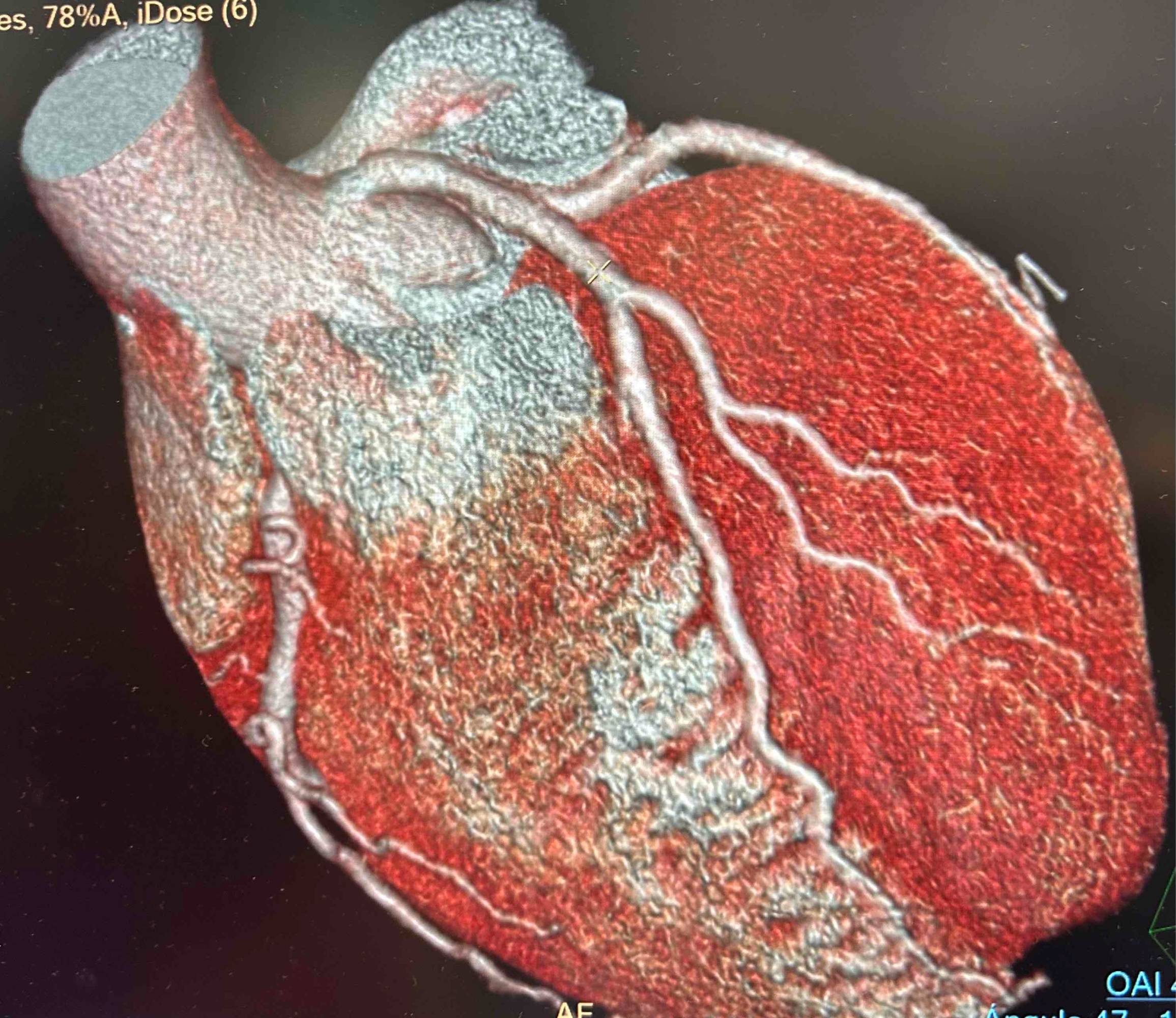 Image embeds on cast Image embeds on cast