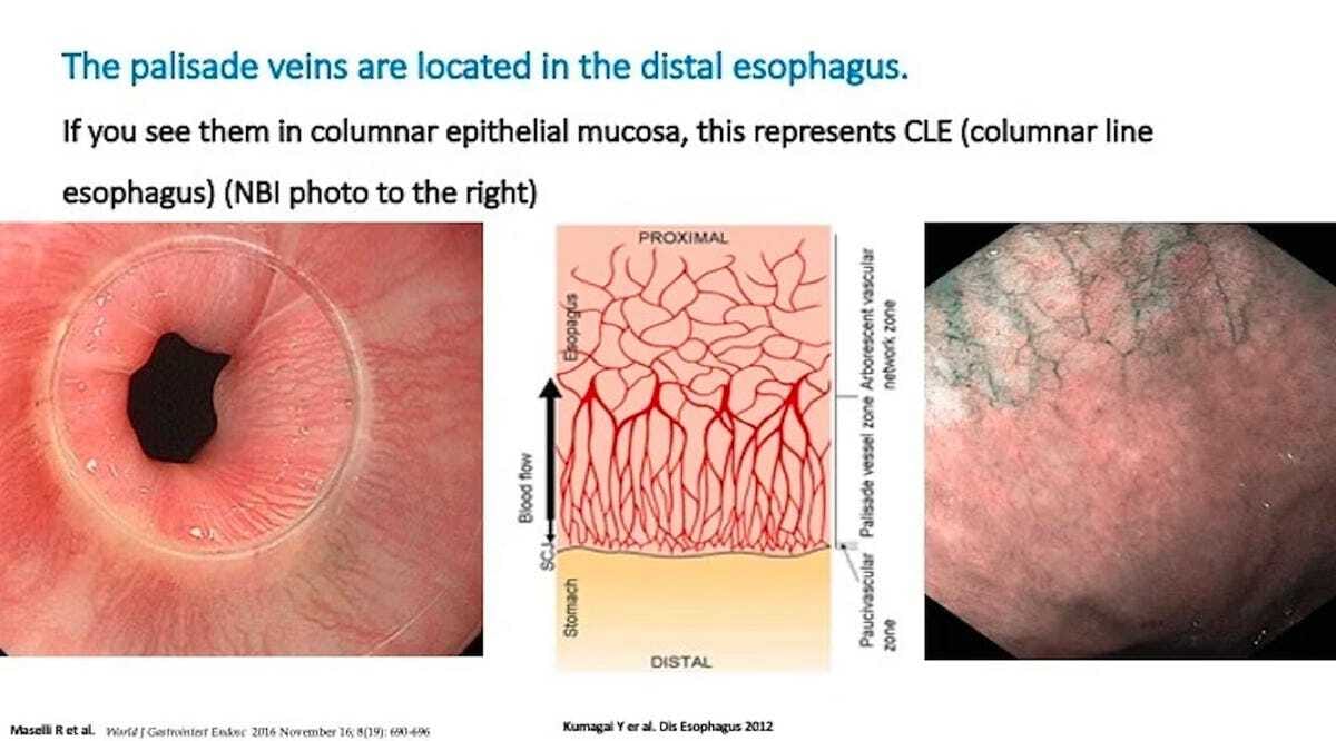 What Are The Palisade Veins? 1 What Are The Palisade Veins?