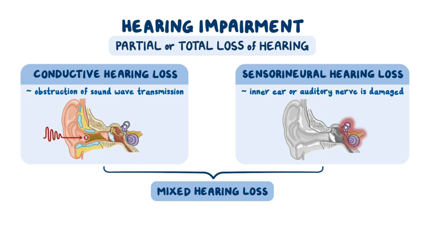 Conductive vs Sensorineural Hearing Loss: Making Sense of the Tuning Fork