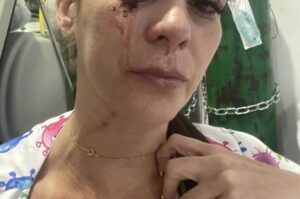 Enfermeira é agredida em hospital de Rondônia por mãe de paciente