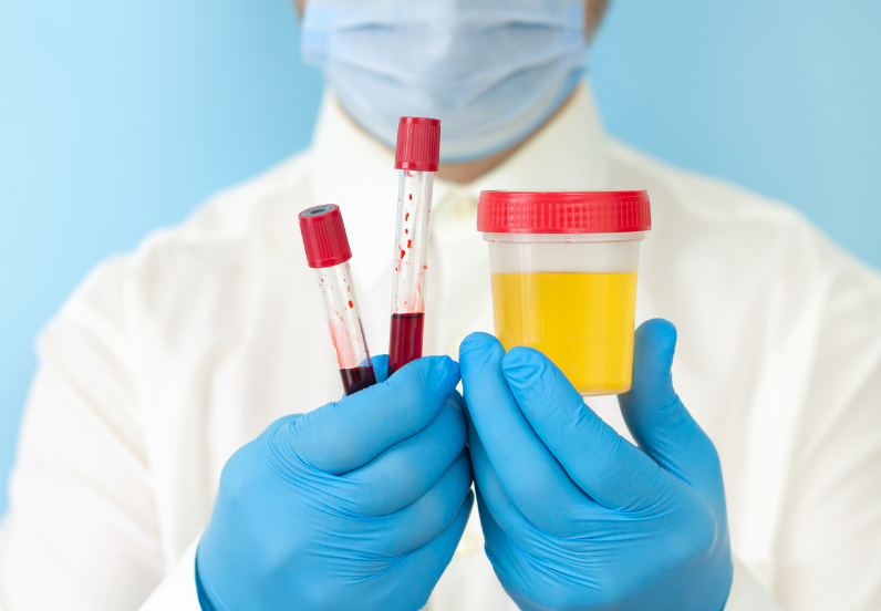 Potassium oxalate crystals