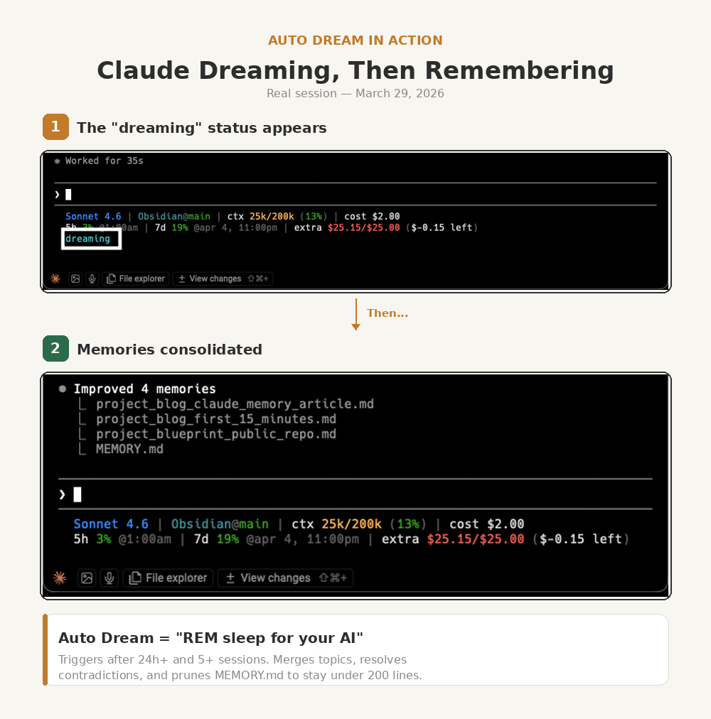 Memory Panel Claude Has 5 Memory Layers. Most People Use 1