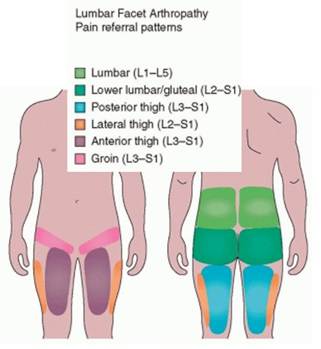 Clinician’s Corner: Differentiating Hip Joint, SIJ, and Lumbar Spine Pain