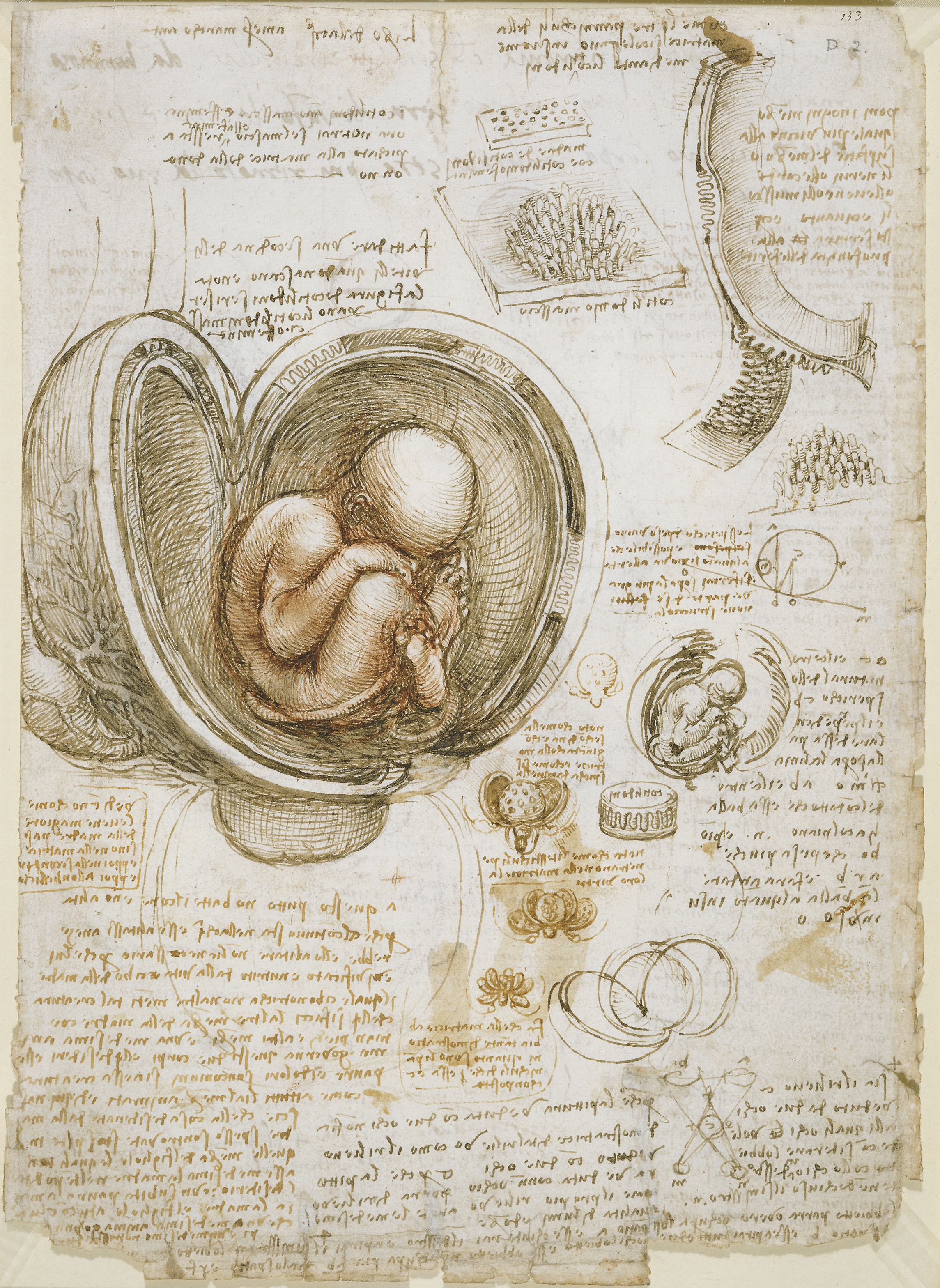 Leonardo da Vinci's anatomical drawing of a fetus in the womb