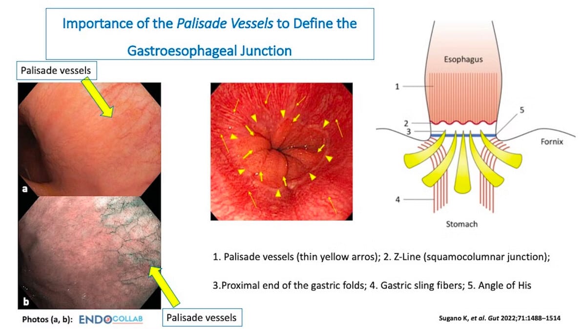 What Are The Palisade Veins? 2 What Are The Palisade Veins?