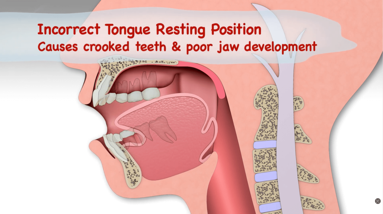 Mastering Proper Tongue Posture A Guide For Improved Breathing And Posture mastering-proper-tongue-posture-a-guide-for-improved-breathing-and-posture